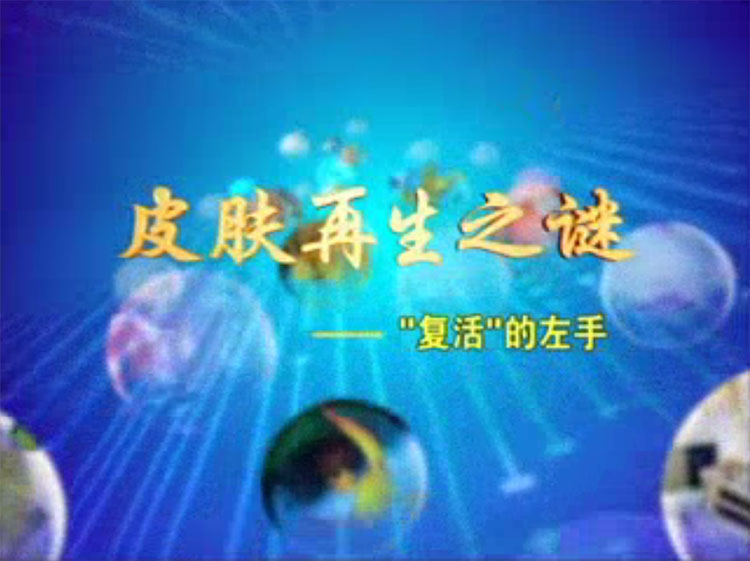 皮肤再生之谜--"复生" 的左手